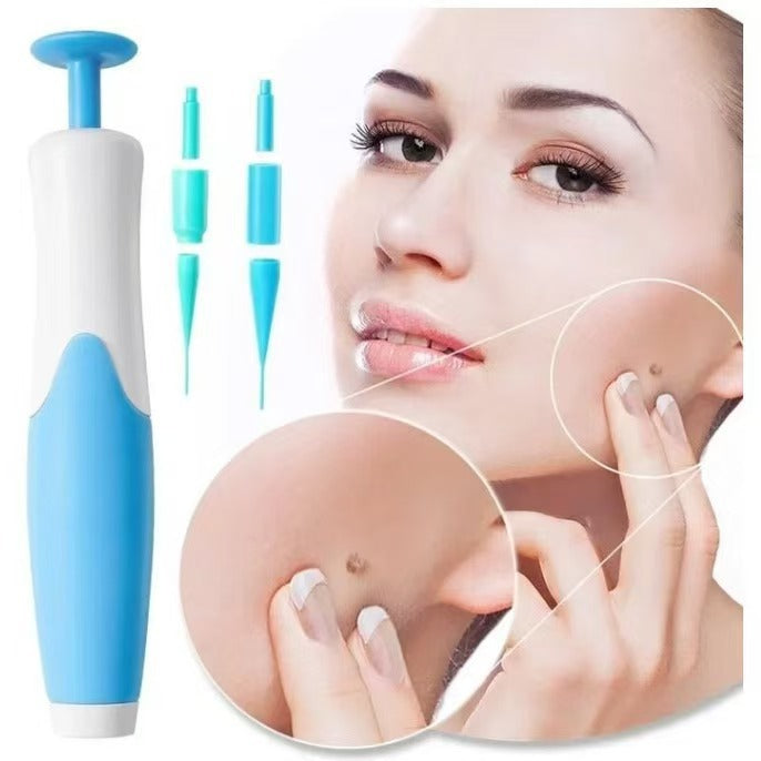 Skin Tag Removal Tool (Blue Box)