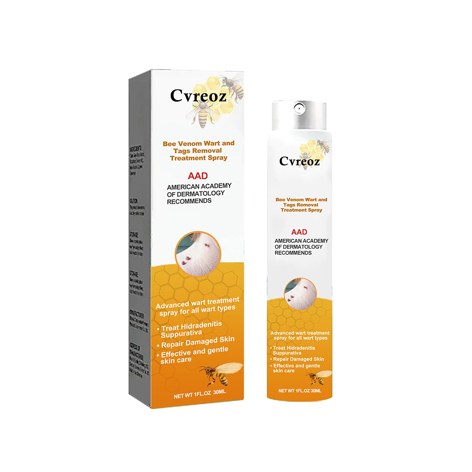 Bee venom wart care spray skin cleansing repair fade mole corn body care spray 20ml