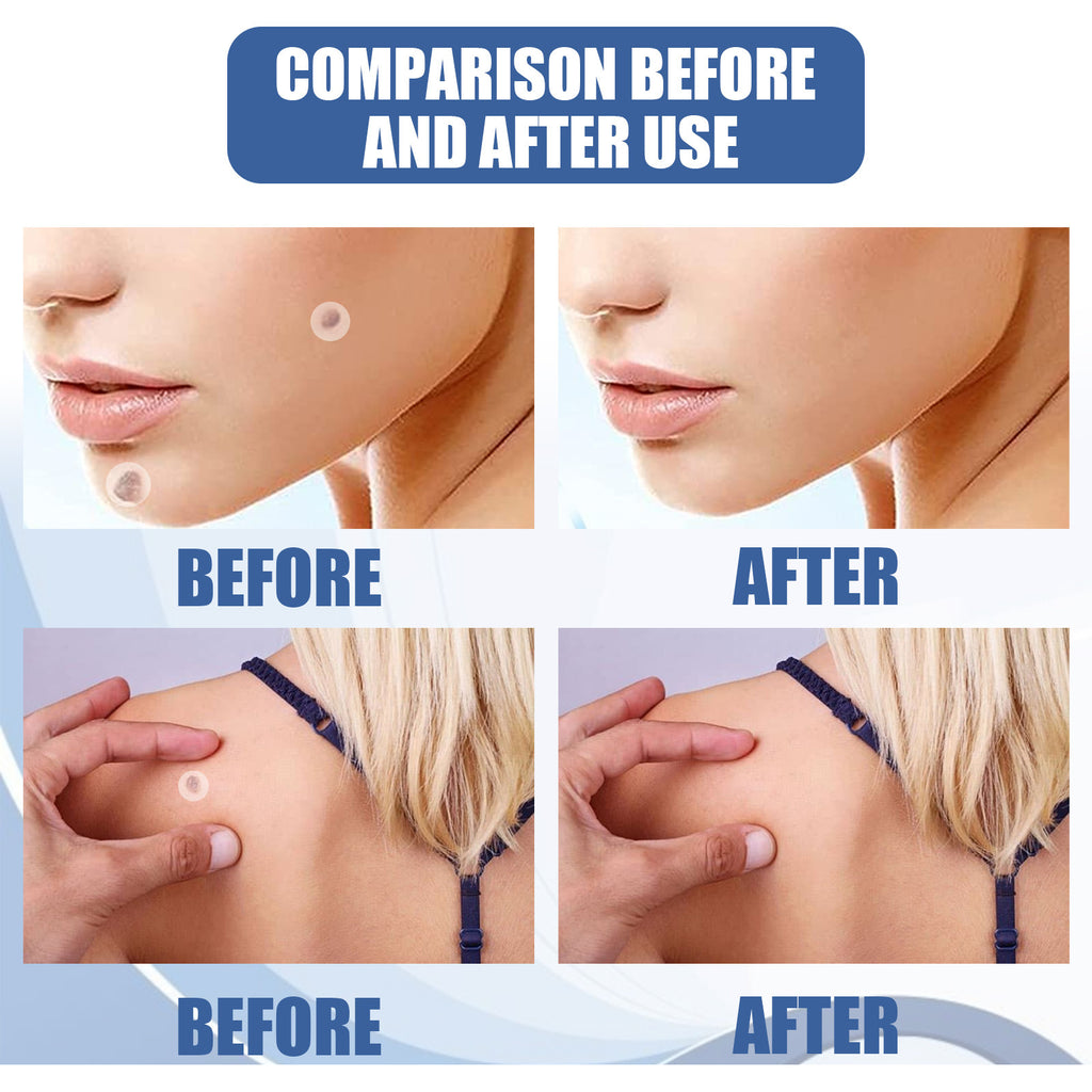 Keyou patch Gentle cleansing care skin face neck repair smooth skin daily care