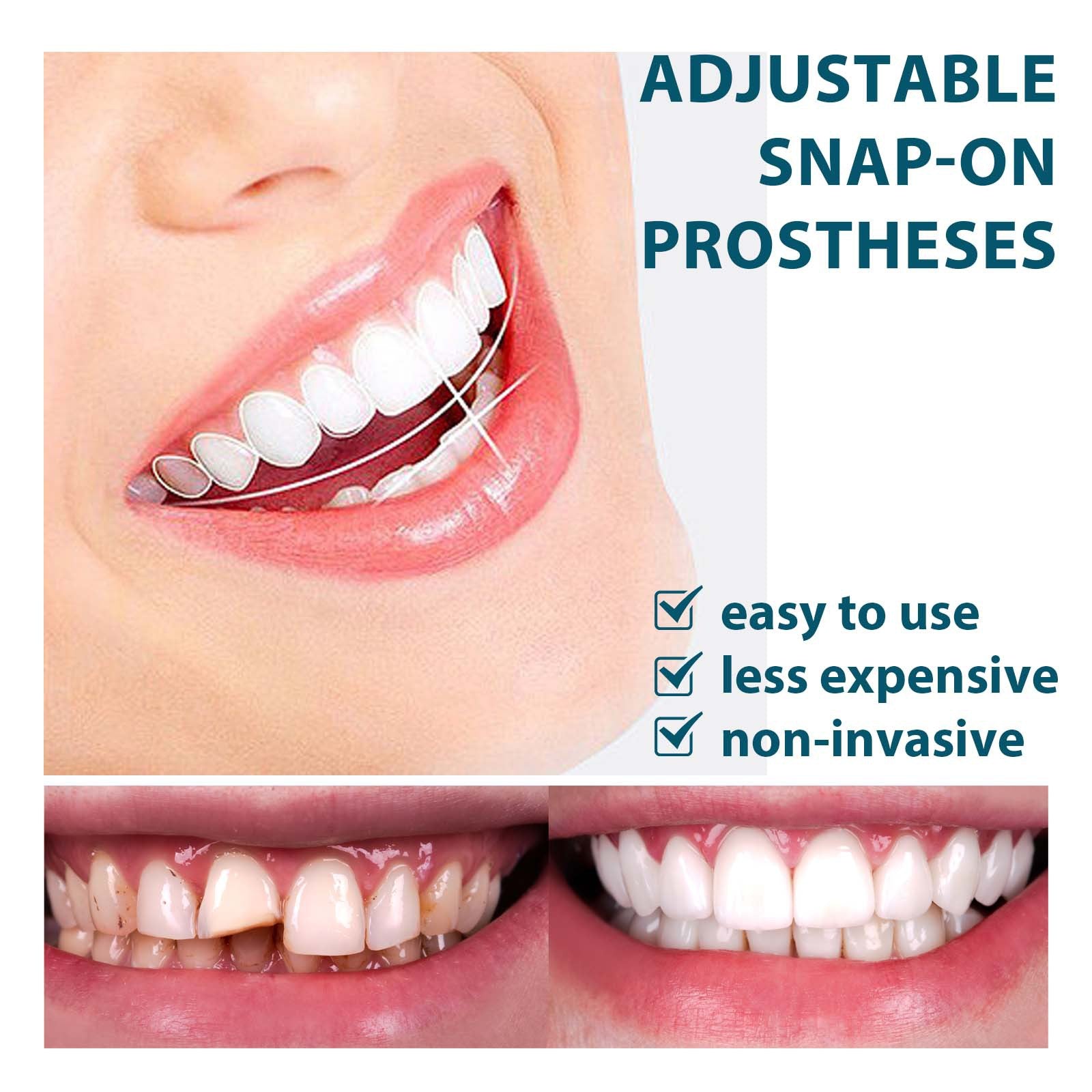 EELHOE adjustable snap-on dentures to modify teeth, fill gaps between teeth, correct braces, and denture kits