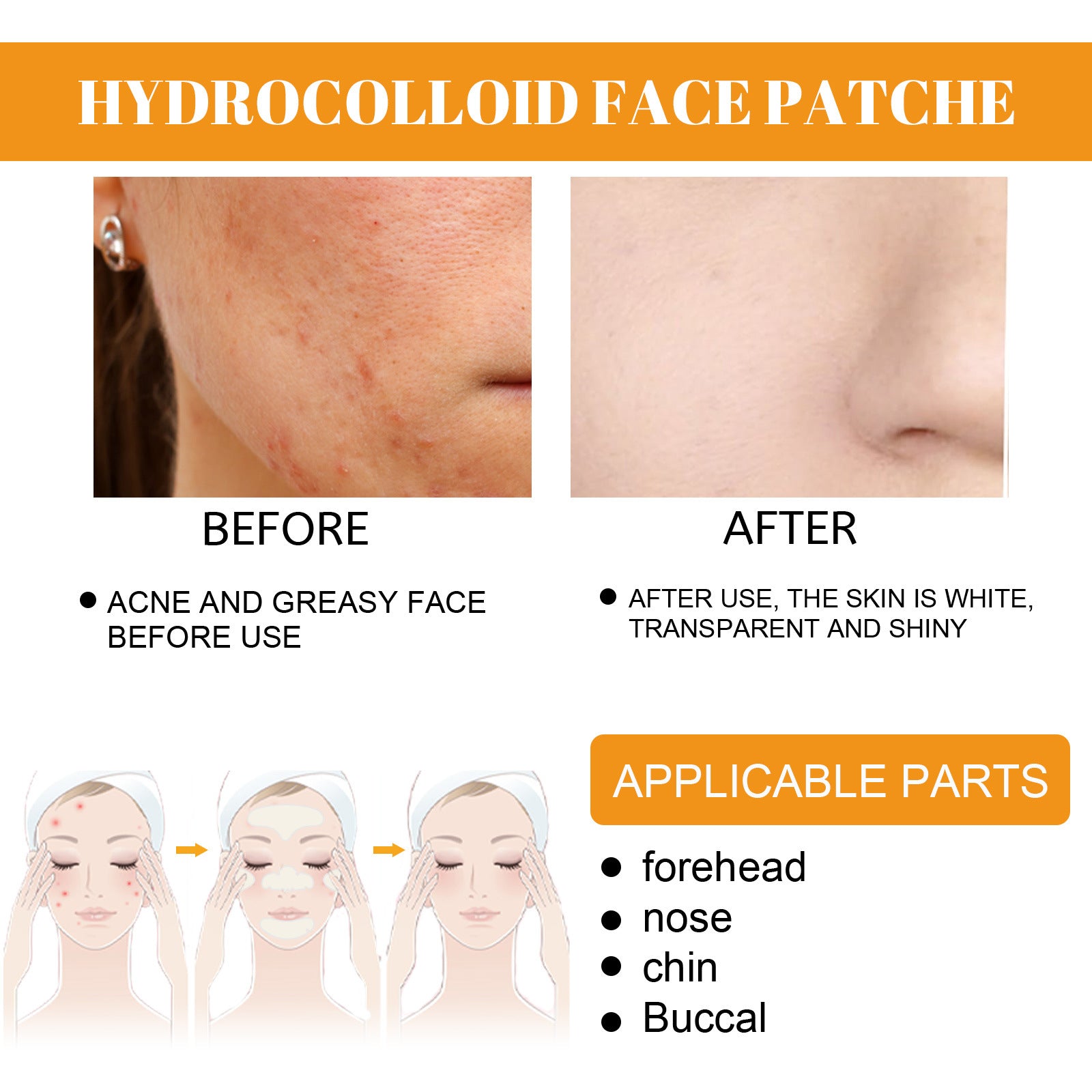EELHOE hydrogel facial acne patch portable transparent invisible hydrogel anti-acne patch facial care concealer