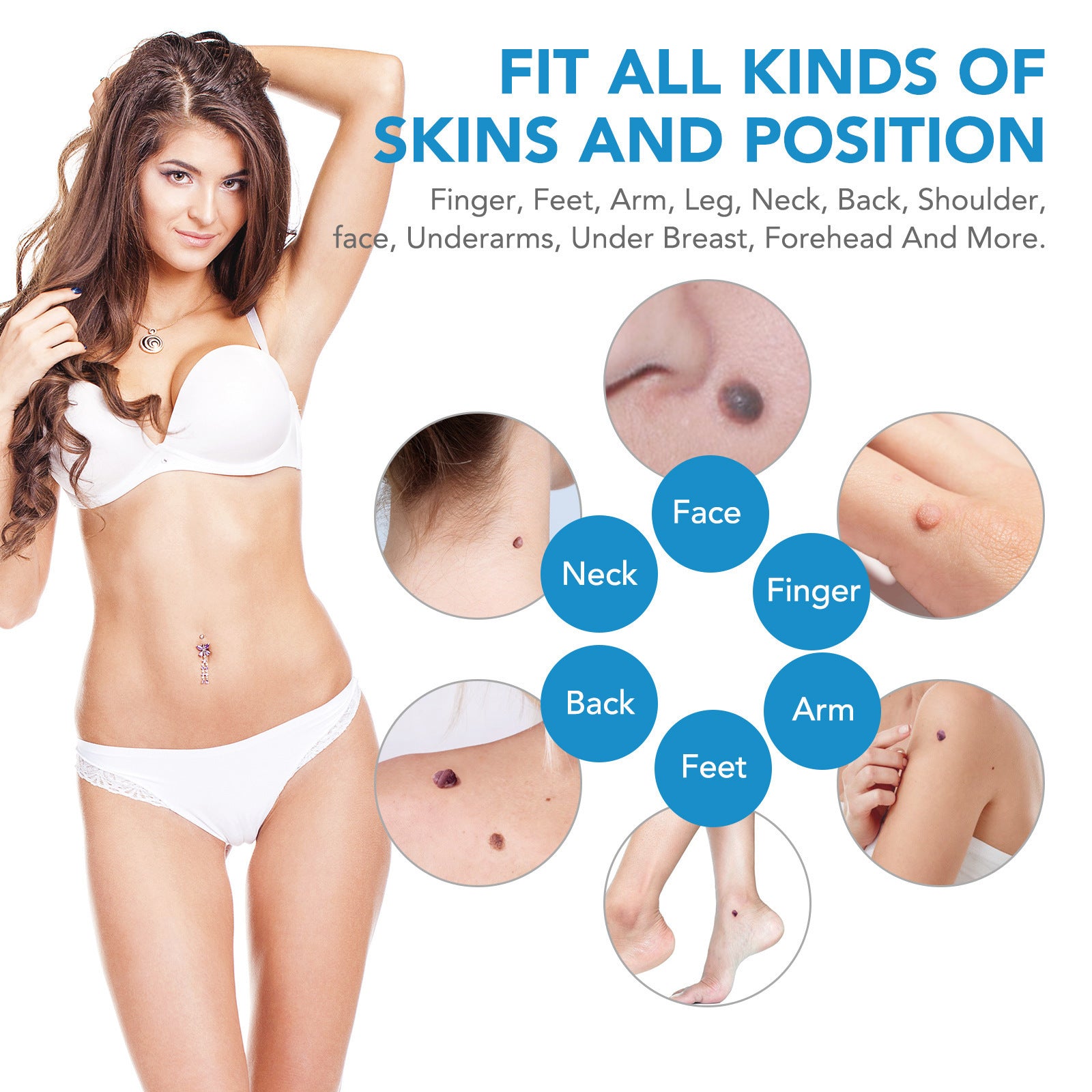 Skin Tag Removal Tool (Blue Box)