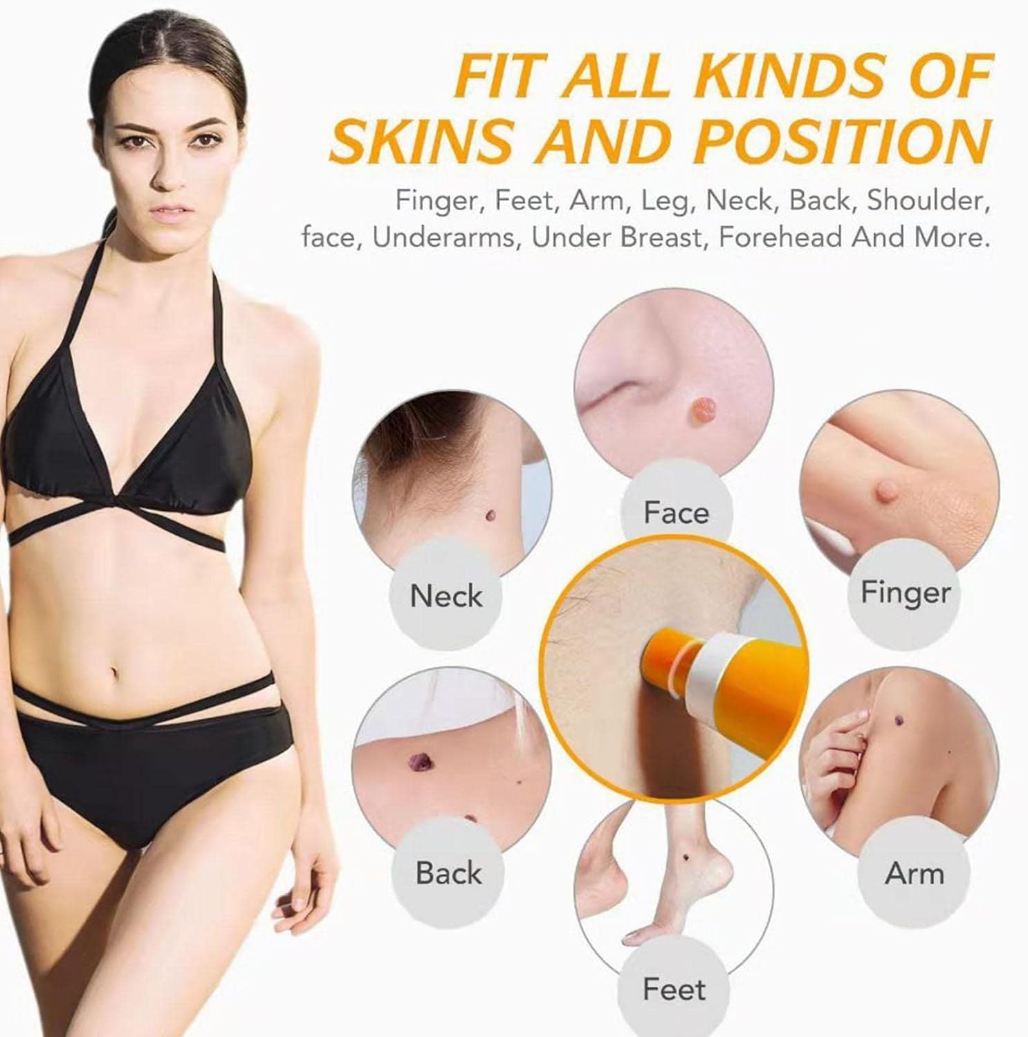 Skin Tag Removal Tool (Blue Box)