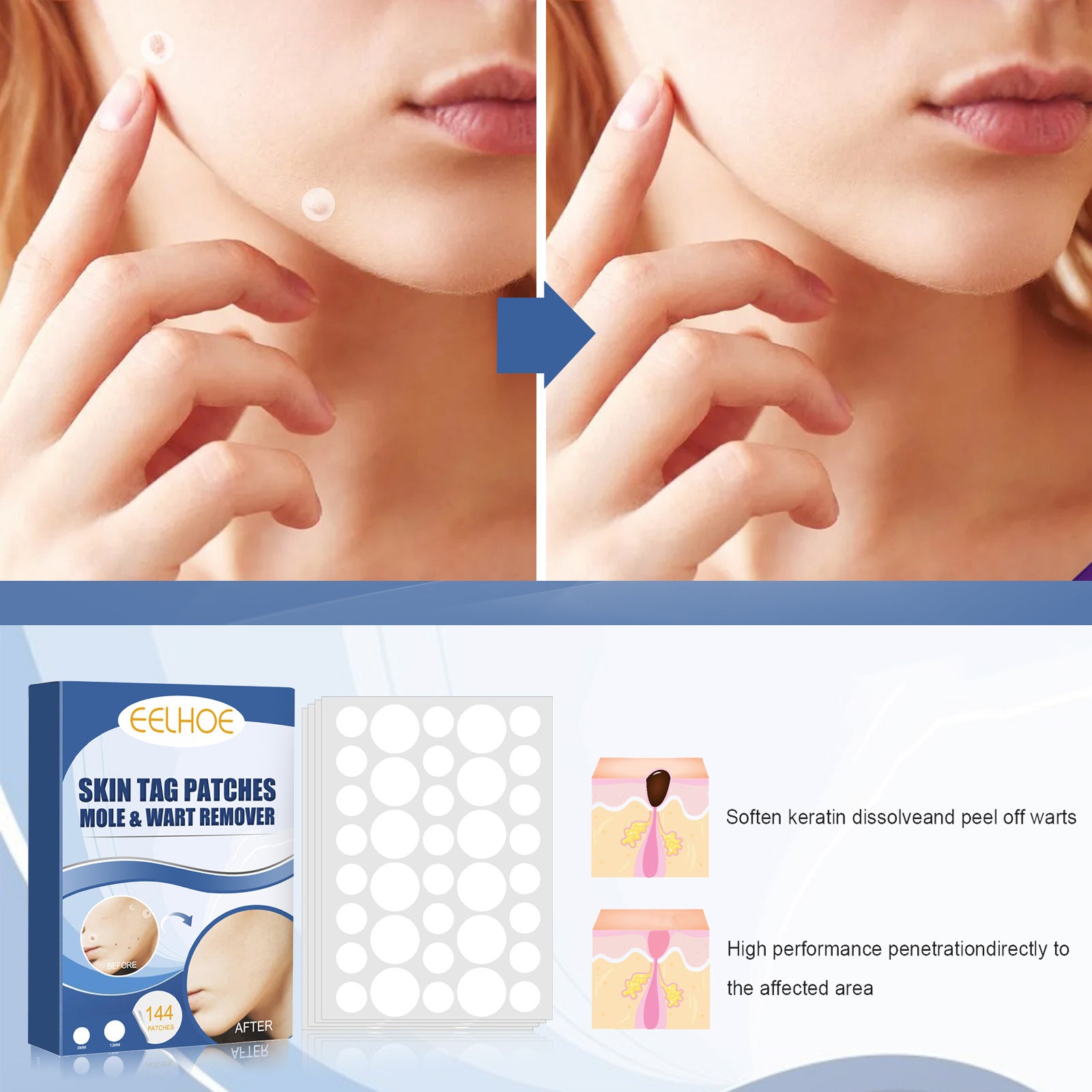 Keyou patch Gentle cleansing care skin face neck repair smooth skin daily care